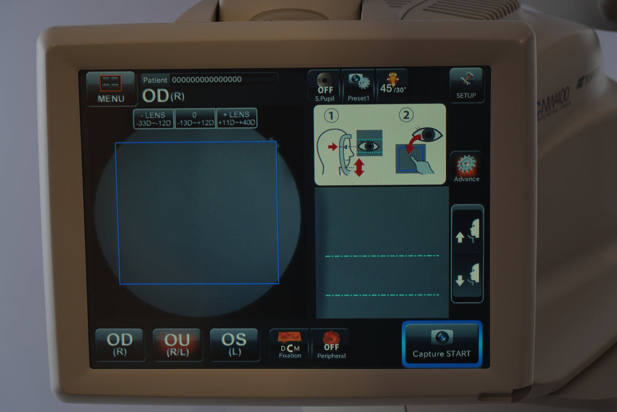 Topcon TRC-NW400 Non-Mydriatic Retinal Camera