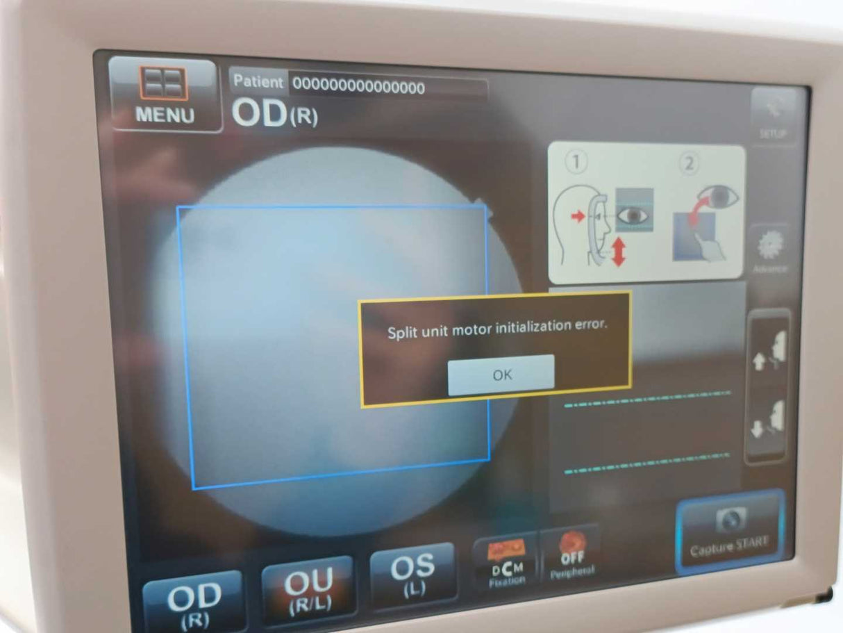 TOPCON TRC-NW400 Non-Mydriatic Retinal Camera - Split unit motor error