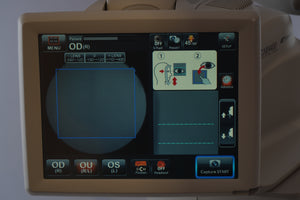 Topcon TRC-NW400 Non-Mydriatic Retinal Camera